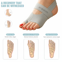 Hyggear Corrector de Juanetes [Dedo Gordo del Pie, Hallux Valgus] - 120235761433270655